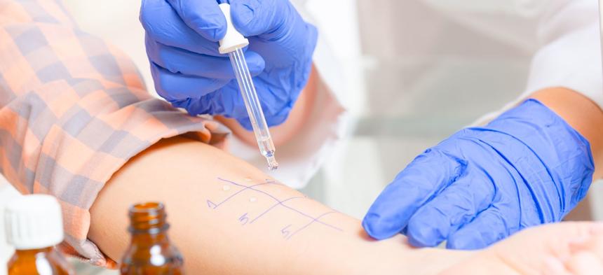 Allergy Testing Methods: Understanding the Differences between Scratch  Tests and Patch Tests